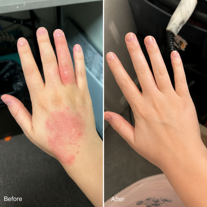 Crème voor Huidontsteking & Gezonde Huid – Verlicht jeuk, roodheid en schilfering 50ml - Afbeelding 9